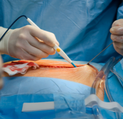 ELECTRO SURGICAL