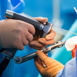 Orthopedic Instruments